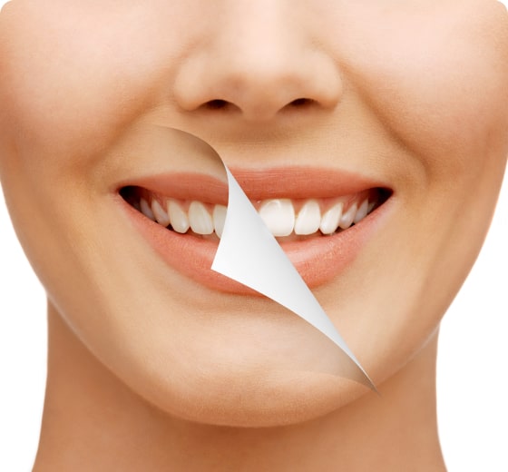 before and after smile gallery burke dentist