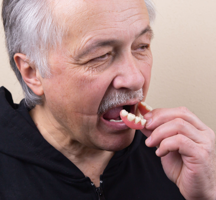 dental patient placing his conventional dentures