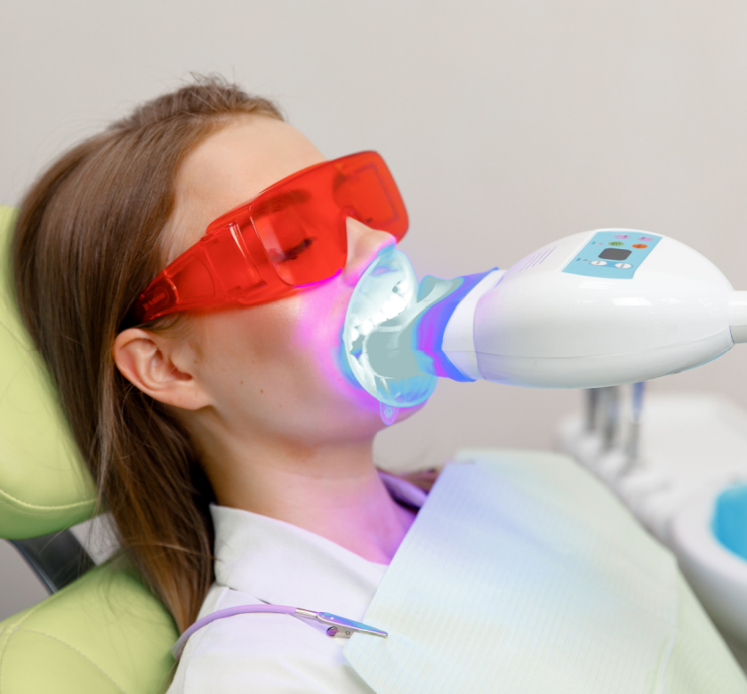 teeth whitening at the dentist