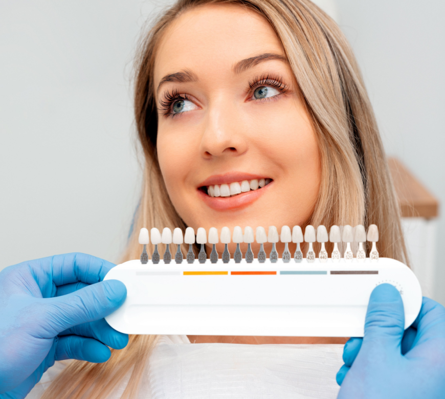 teeth whitening burke va